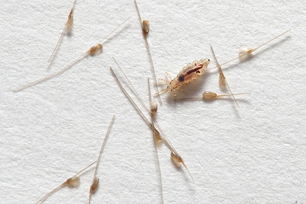 Head Lice Pictures | Adult Head Lice - Louse and eggs in hair | NitWits
